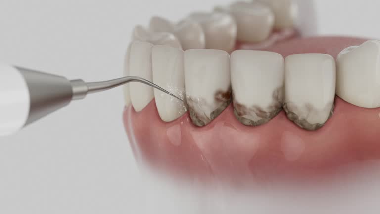 Reliable Emergency Dentist contractor in Morton, MS by Smile Center Dentistry